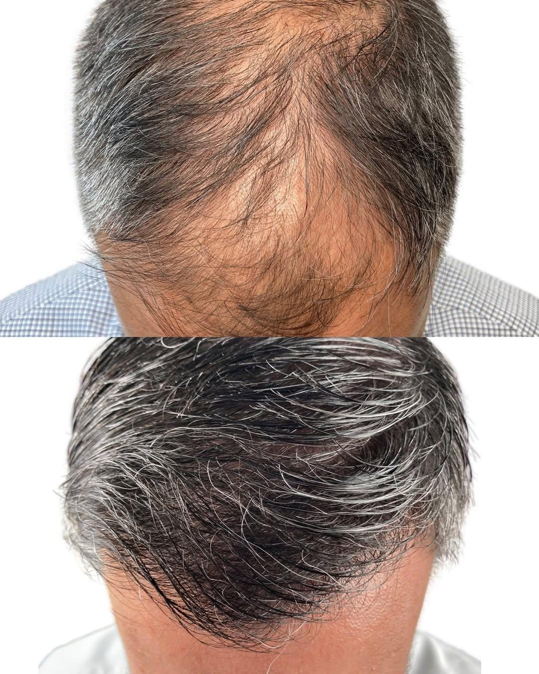 Hair Growth Elixir